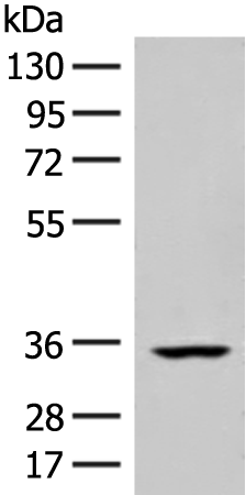 FBXO16 Antibody