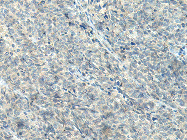 NPVF Antibody