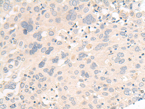 FHOD1 Antibody