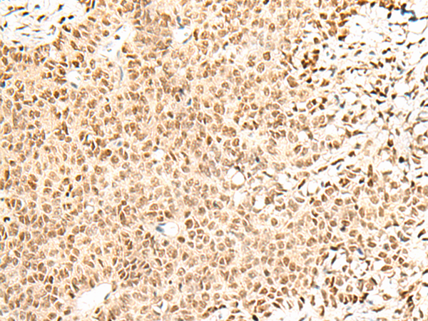 FKBP5 Antibody