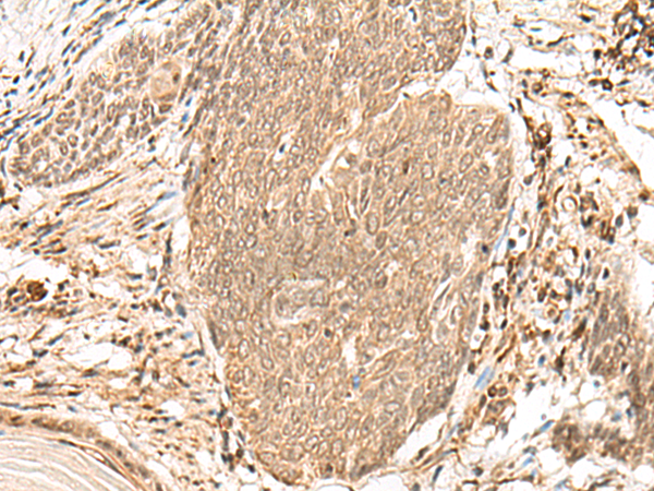 VPS50 Antibody