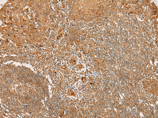 FLNC Antibody