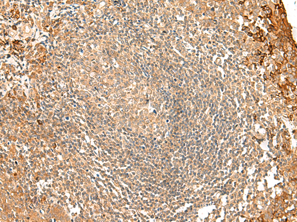 FNBP1L Antibody