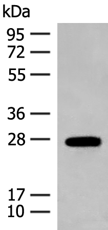 GUCA1B Antibody