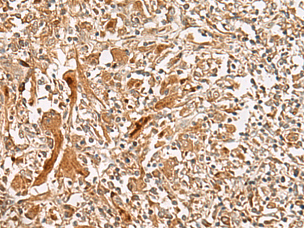 GCC2 Antibody
