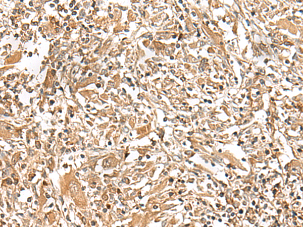 GEMIN4 Antibody
