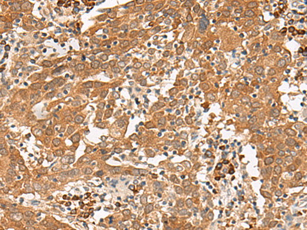 GFI1 Antibody