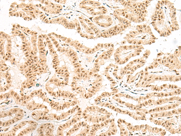 BICRA Antibody