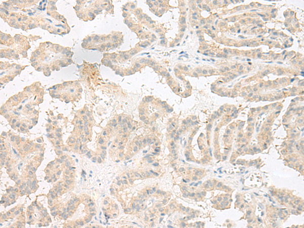 EPRS Antibody