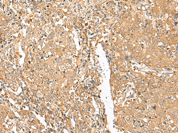 GOLGA6A Antibody