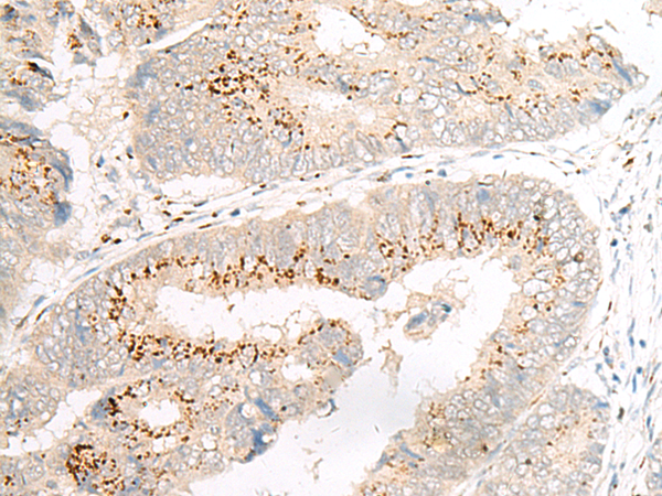 GOLIM4 Antibody