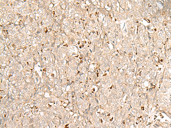 NUP210 Antibody