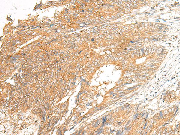 C5AR2 Antibody