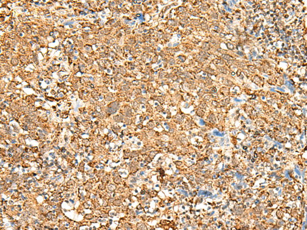 P2RY14 Antibody