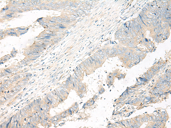 ADGRG6 Antibody