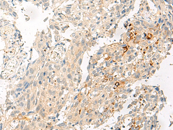 ADGRG1 Antibody