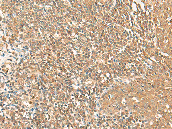 GRIPAP1 Antibody