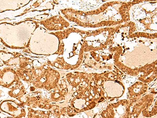 GTF3C3 Antibody