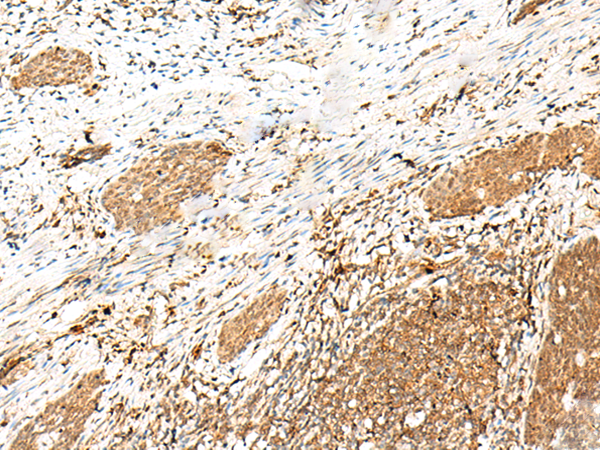 KAT6A Antibody