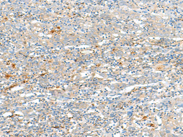 HLA-DQA2 Antibody