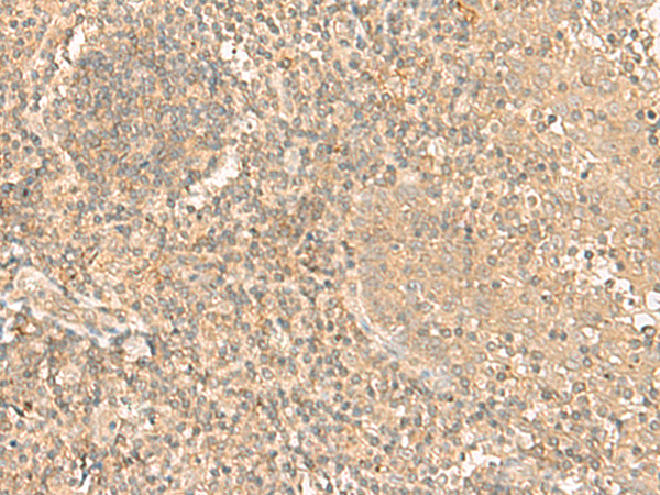 HLA-A/F/H Antibody