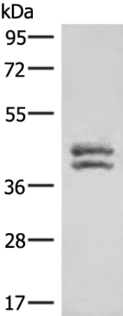 HNRNPAB Antibody