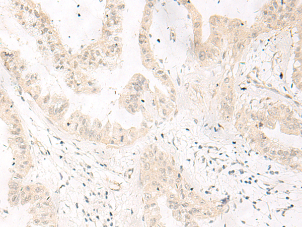 TLX1 Antibody