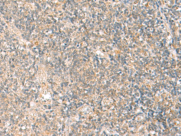 HPDL Antibody
