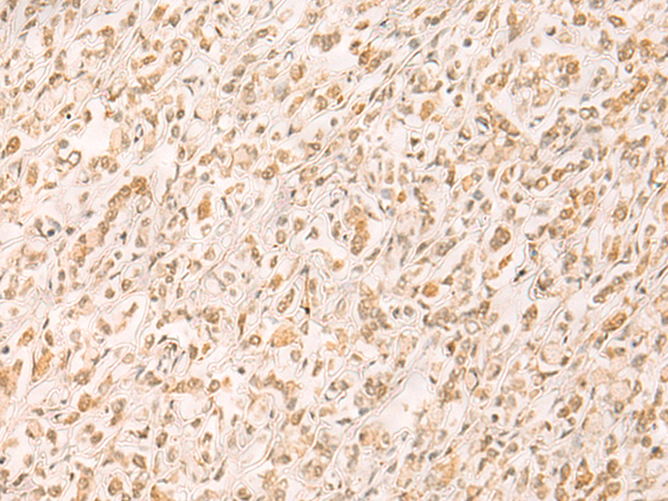 SETD1A Antibody