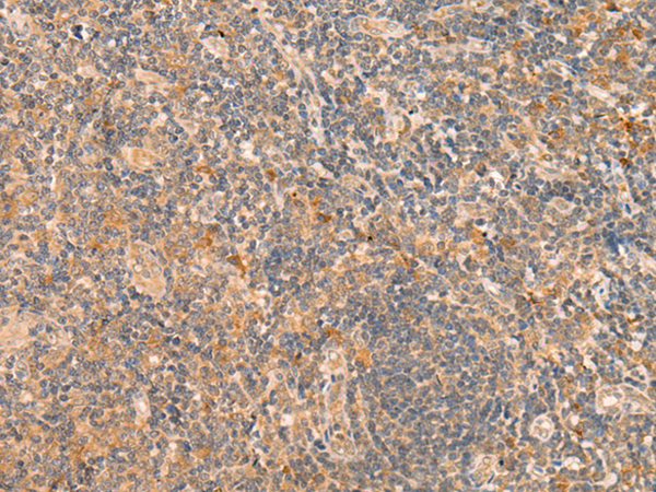 HSH2D Antibody