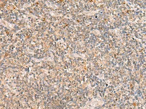 TBCK Antibody