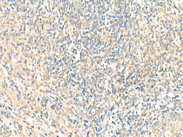 MTIF2 Antibody