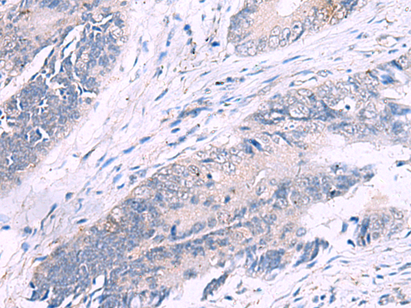 IL4R Antibody