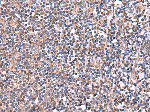INPP5B Antibody