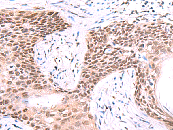 IRF2BP1 Antibody