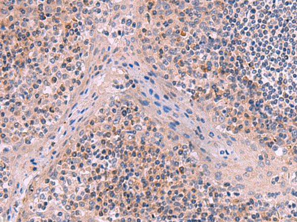 ITIH4 Antibody