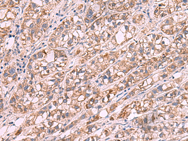JAZF1 Antibody