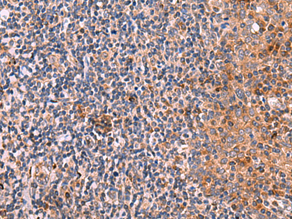 KLK9 Antibody