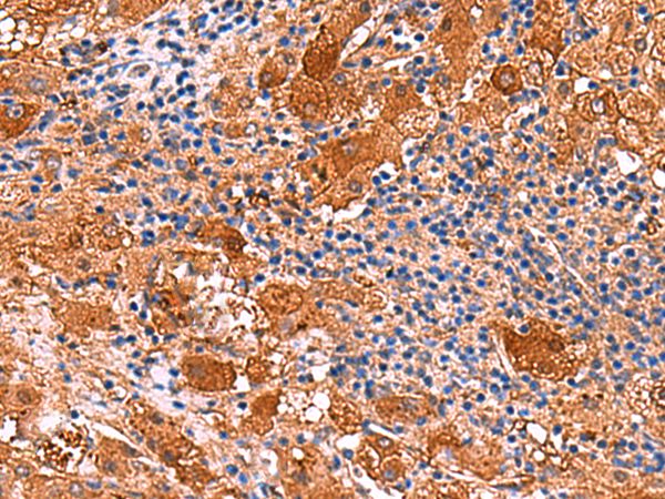 KANK3 Antibody