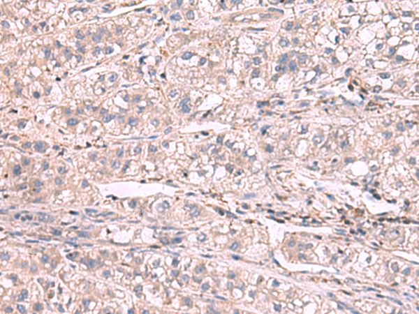 KCNIP1 Antibody