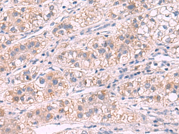 G6PC Antibody