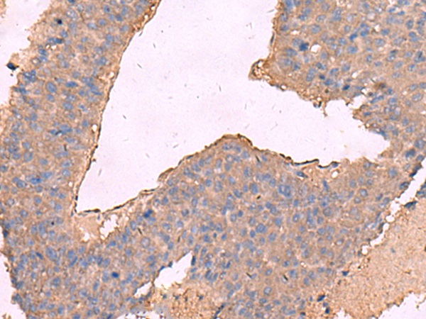KCNN2 Antibody