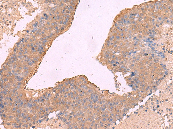 NIPSNAP1 Antibody