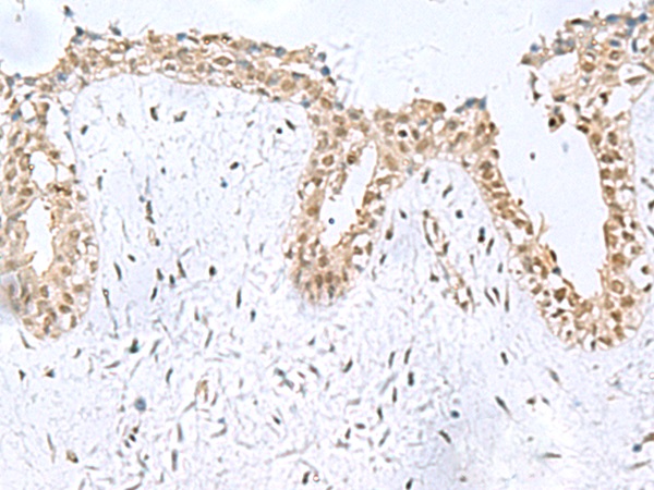 KDM2B Antibody
