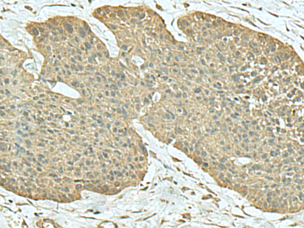 FN3KRP Antibody