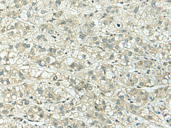 KIF3B Antibody