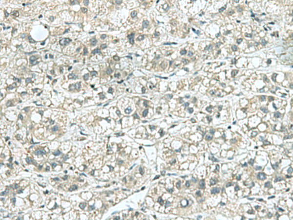 KIF5C Antibody