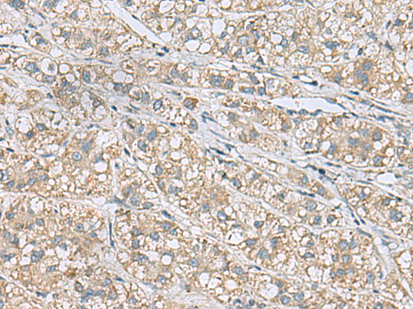 HSPB11 Antibody