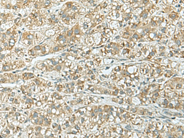 RAP1GAP Antibody