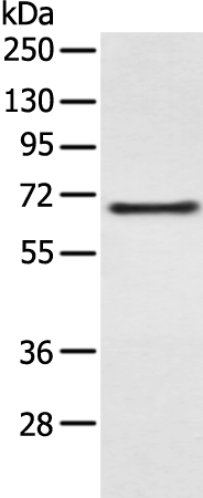 CAPN5 Antibody